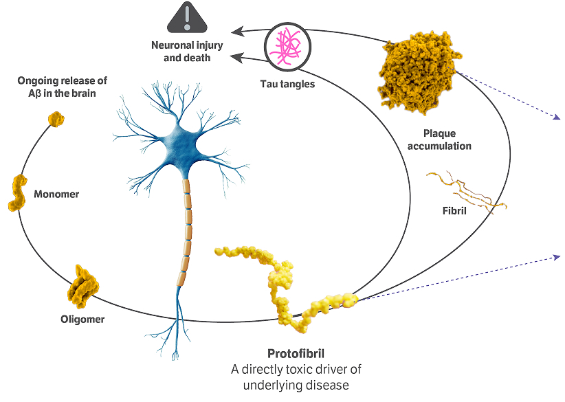 Infographic showing how LEQEMBI clears amyloid plaque and protofibrils